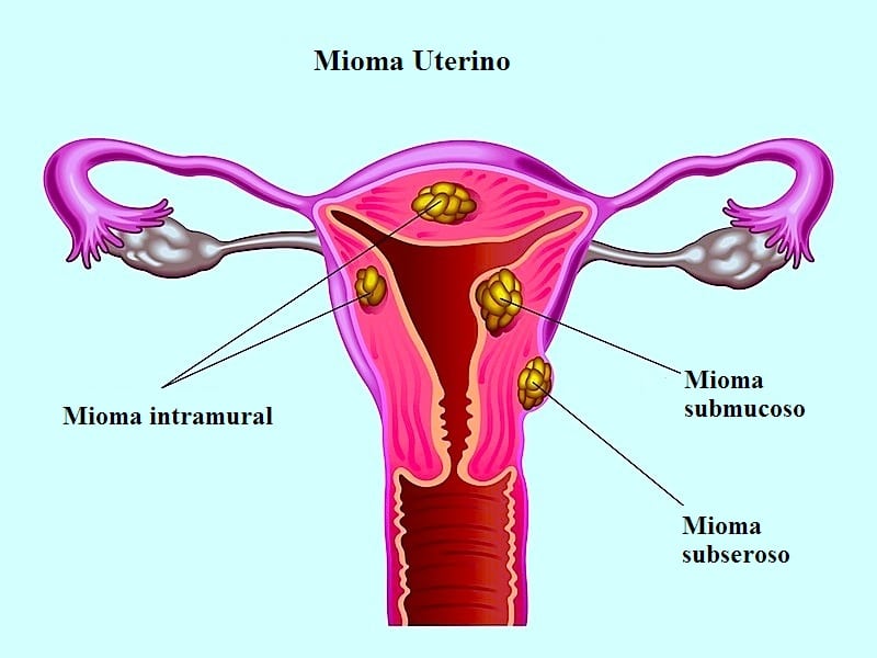 flexeril pregnancy