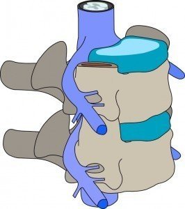 Coluna vertebral com disco intervertebral, raízes nervosa, medula espinhal.
