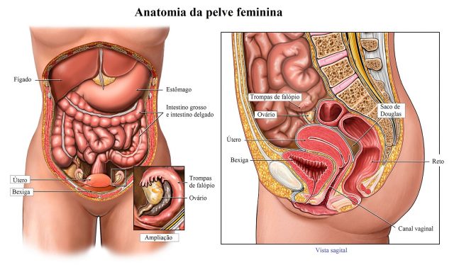 histerectomia,útero,normal