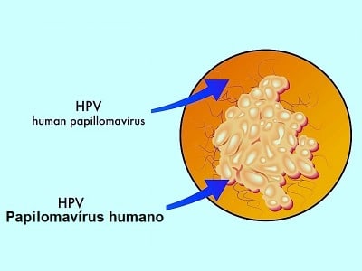 Papiloma vírus