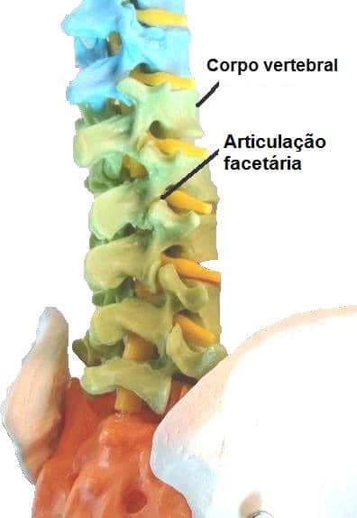 Articulaçaõ facetária,coluna,corpo vertebral