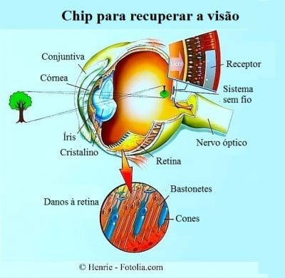 prótese óptica,retina