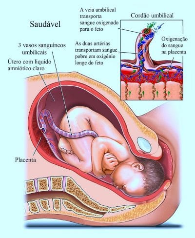 cordão,umbilical,gravidez