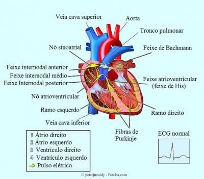 Extra-sístole ventricular