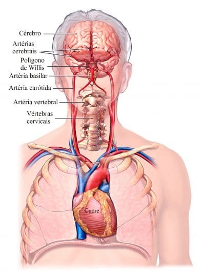 artérias-carótidas-vertebrais-e-cerebrais