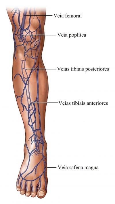  veias,da,perna,capilares