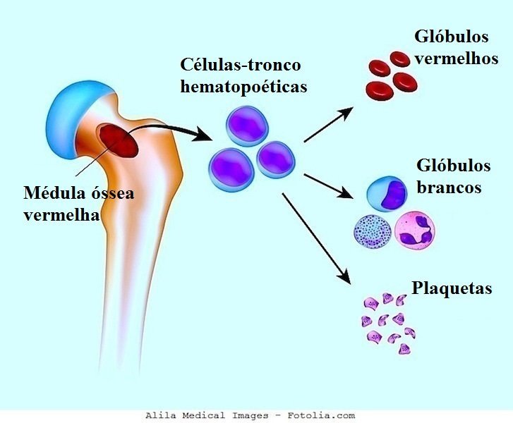  Leucemia,glóbulos,vermelhos,branco, plaquetas