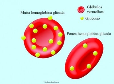 Hemoglobina alta