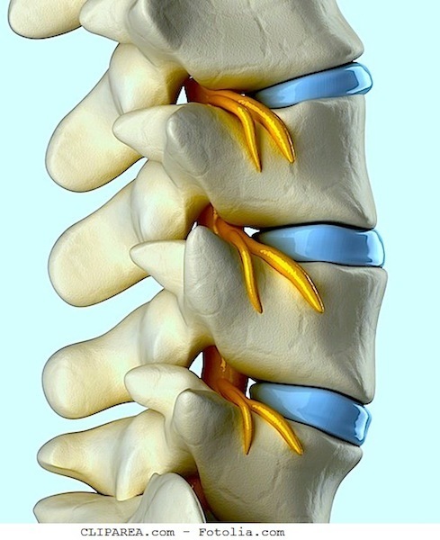 Espinha bífida, coluna, vertebral, lombar