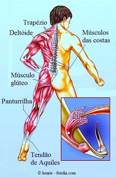 Os sintomas da distensão muscular 