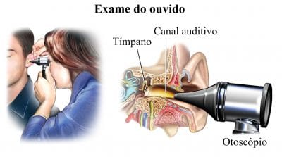 otoscópio,exame,orelha,diagnóstico