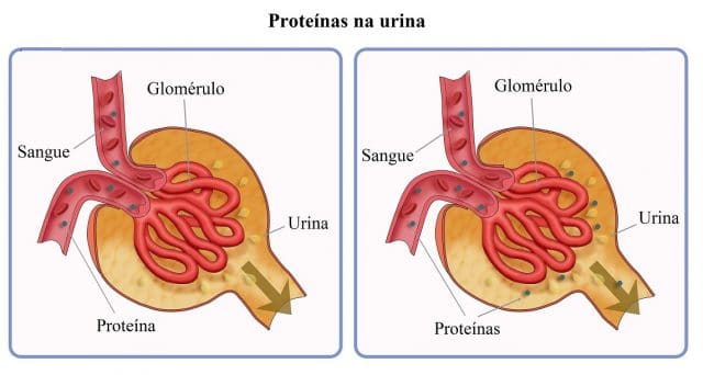 proteínas,na,urina