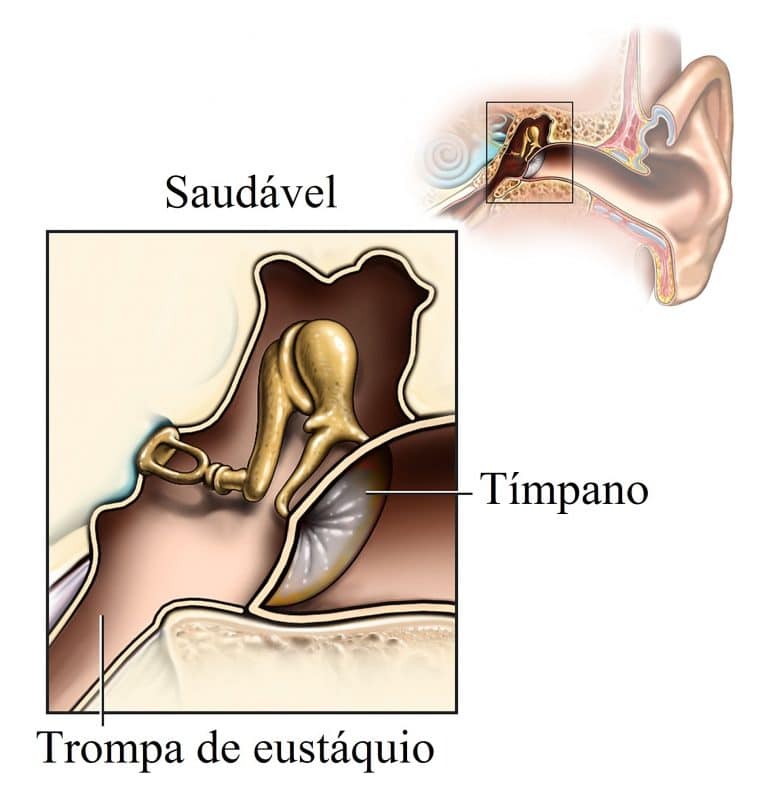 Заложенность уха тубоотит. Острый тубоотит у детей. Тубоотит симптомы у детей.