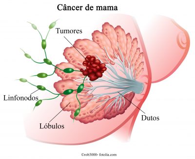 Cancer de mama, anatomia, dutos, lóbulos