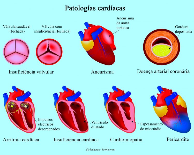 Patologías cardíacas