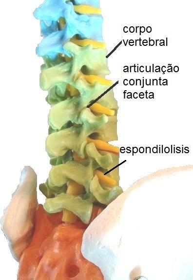 columna vertebral lumbar, vértebras, raíces nerviosas, discos