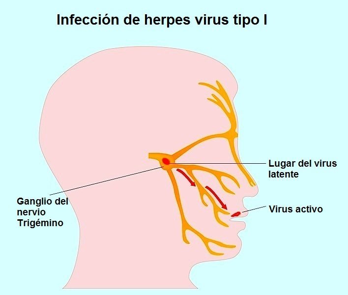 Herpes,simplex,labiale,tipo,I,II,1,2,dolore,infezione,virus,contagioso