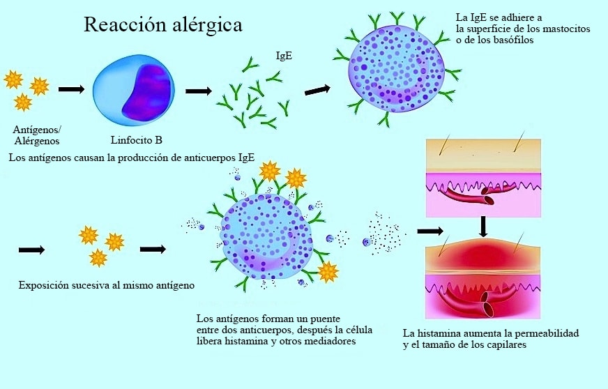 Antihistaminicos para alergia