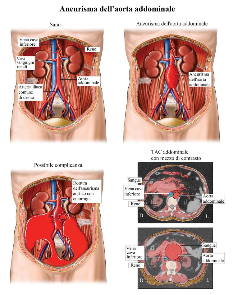 Dolor de barriga bajo, inferior, intestino, caderas, riñones