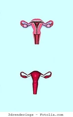 útero, ovarios, sequedad-vaginal