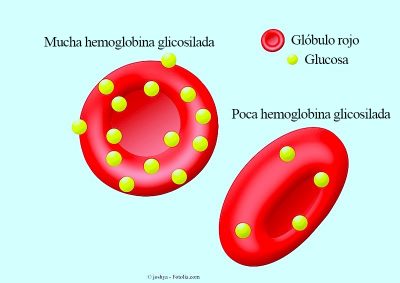 Hemoglobina glucosilada