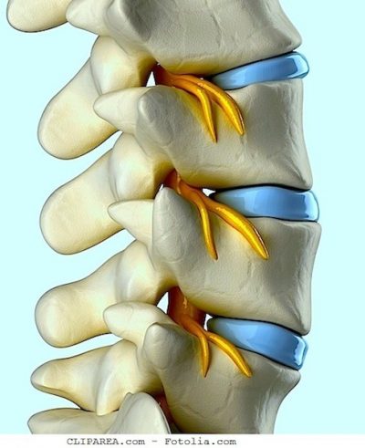  espina bífida, columna vertebral, lumbar