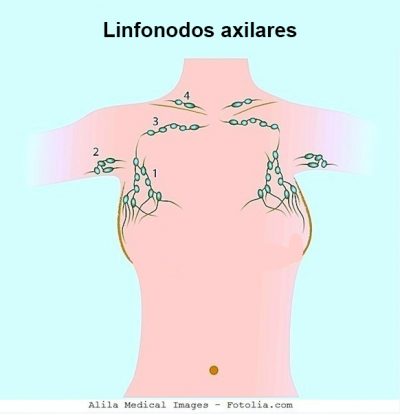 linfonodos axilares, clavícula, linfonodos centinela