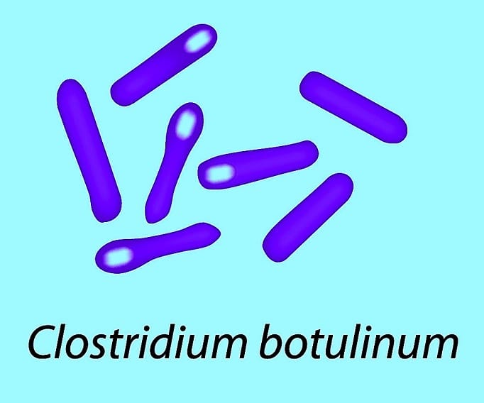 Кластридии. Ботулинический Токсин Clostridium botulinum. Клостридии ботулизма ( Clostridium botulinum ) ботулизм. Клостридия ботулинум анаэроб. Clostridium botulinum окраска.