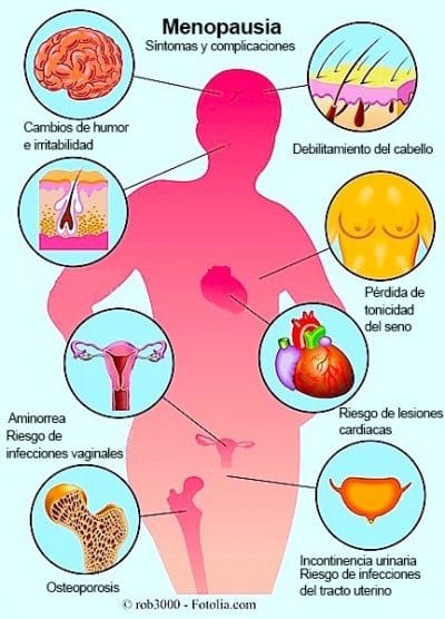 Menopausia, síntomas, causas, edad