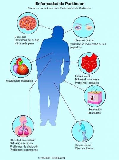 sintomas no motores Parkinson