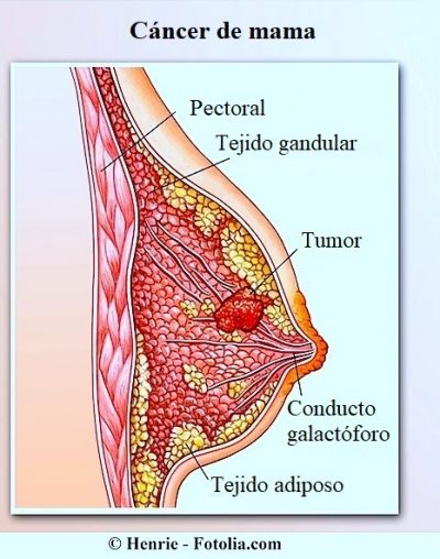 Cáncer de mama, anatomía