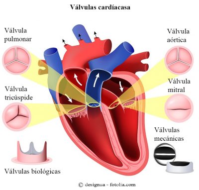 válvula cardiaca, biológica, mecánica