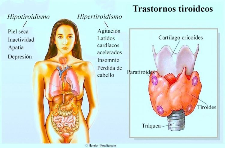 hipertiroidismo, hipotiroidismo, tiroides